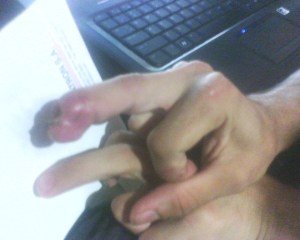 Foto enviada por Padilla que documenta su recuperación.